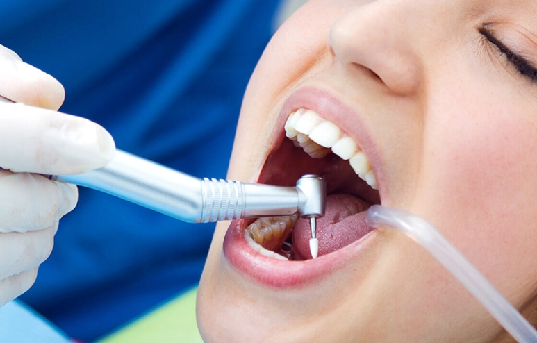 dental deep cleaning reviews