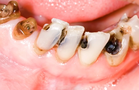 hidden sugars in food