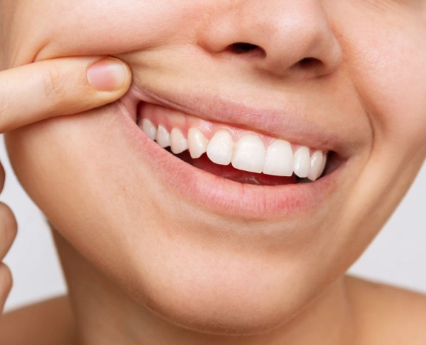 how to get healthy gums how to get healthy gums