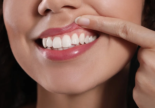 bleeding gums treatment bleeding gums treatment