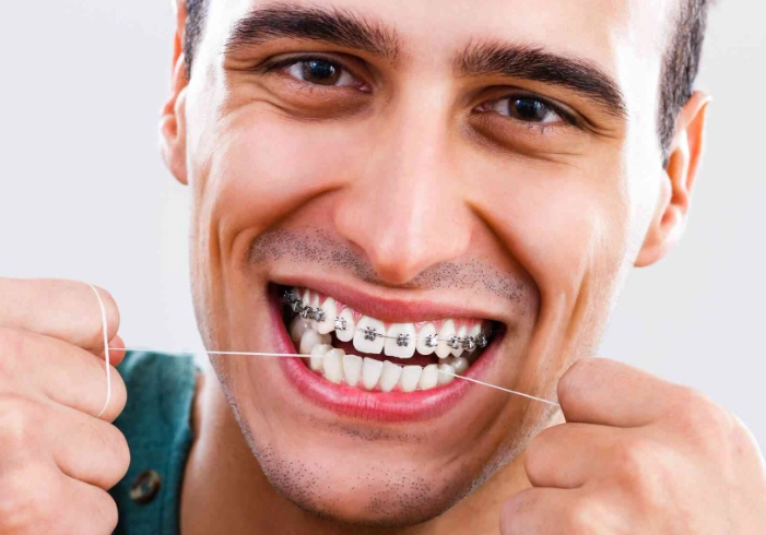 cost of braces for adults