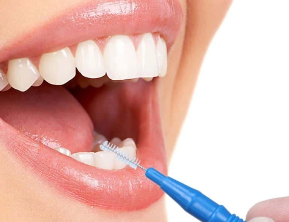 interdental cleaning