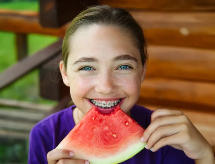 braces friendly foods