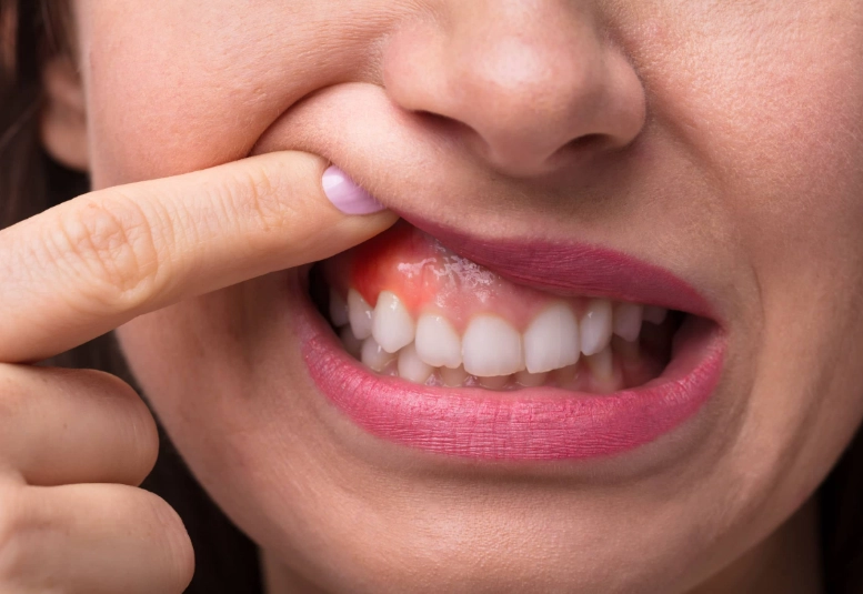 how to stop sensitive teeth pain how to stop sensitive teeth pain