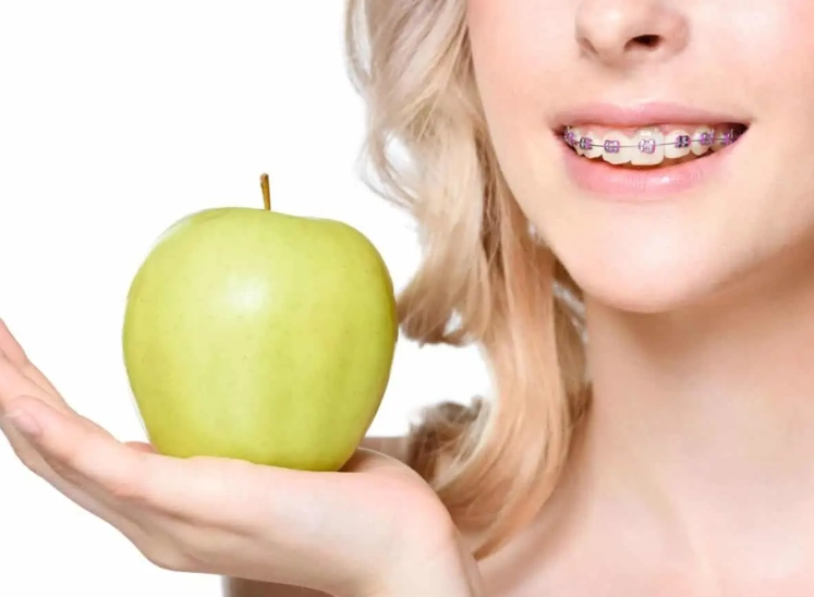 braces friendly foods