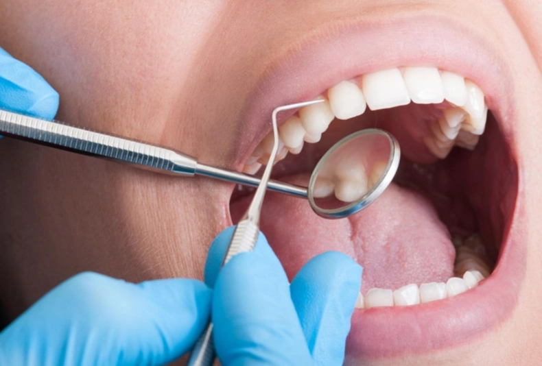 how to treat cavities how to treat cavities