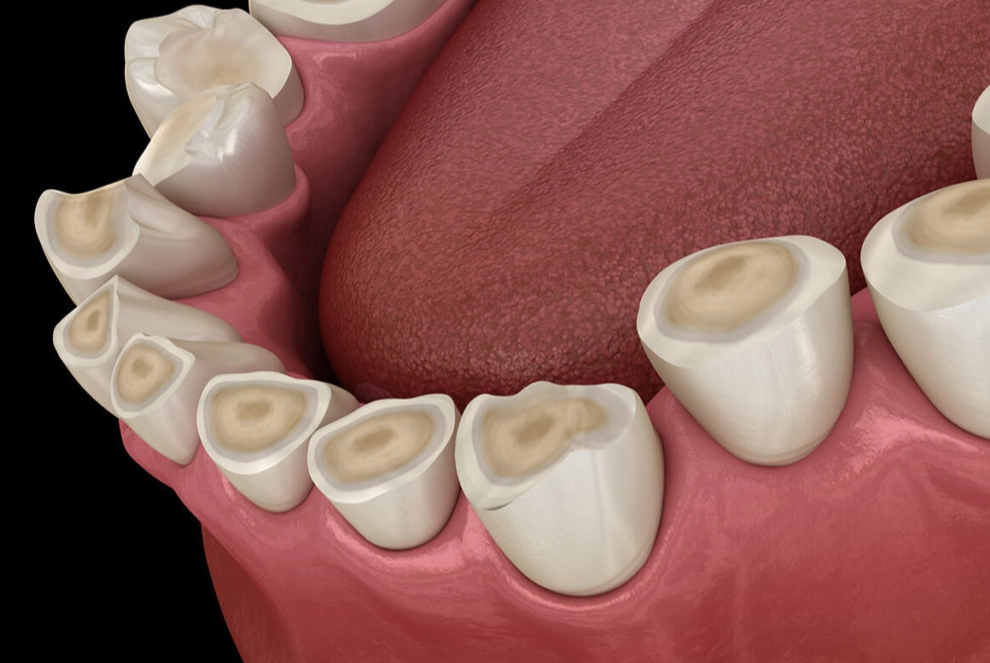 how to stop clenching jaw