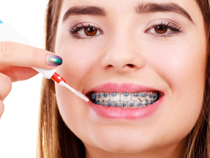braces care routine braces care routine