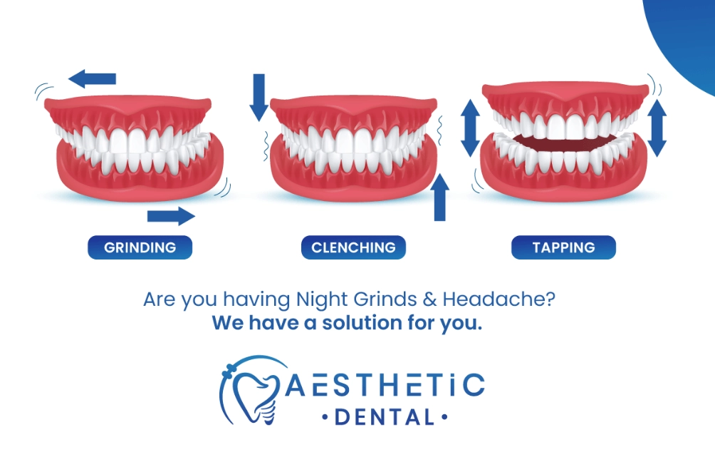 teeth grinding causes