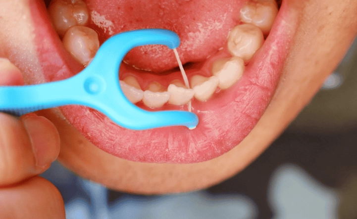 benefits of flossing daily