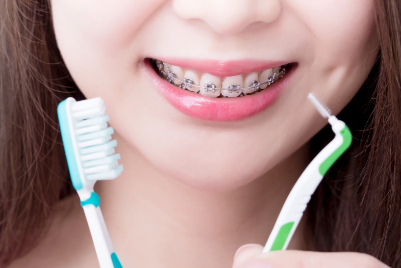 how to clean braces how to clean braces
