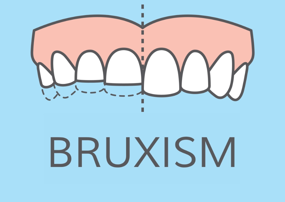 how to stop clenching jaw