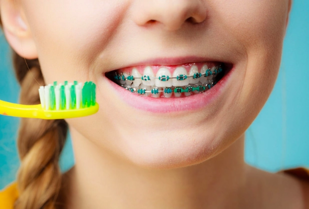 braces care routine braces care routine