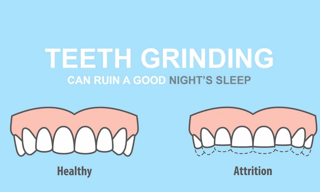 how to stop grinding teeth in sleep