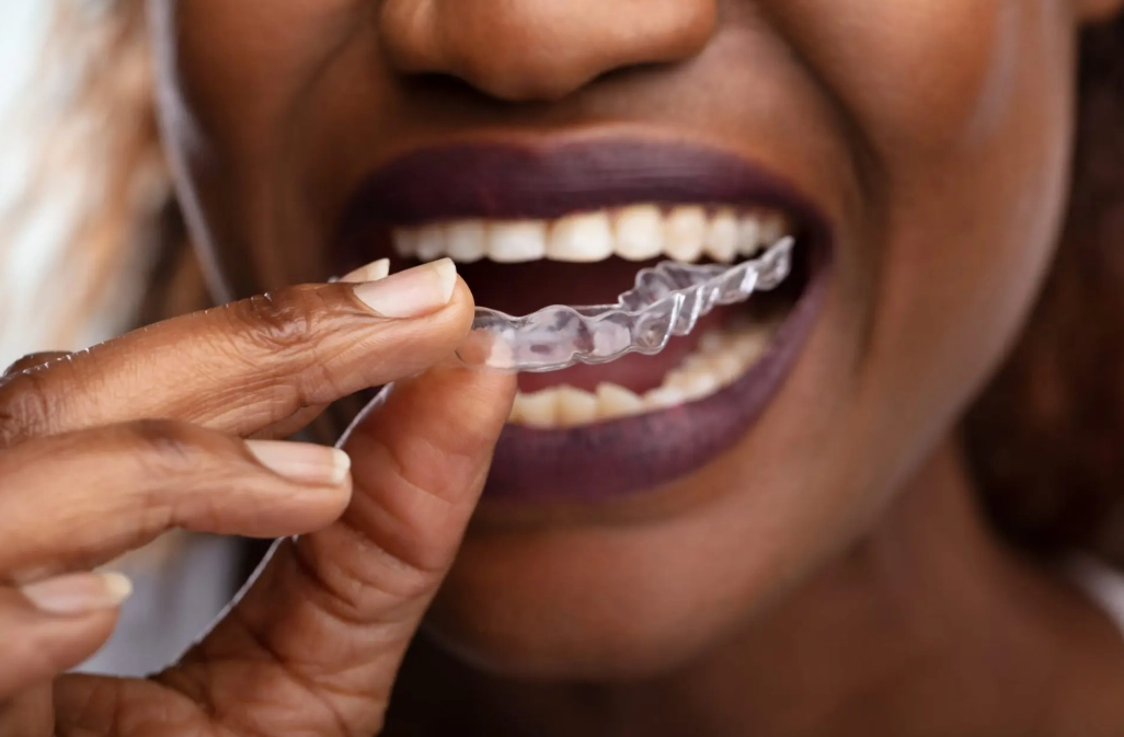 night guard for bruxism