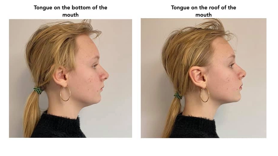 sleeping positions to prevent teeth grinding