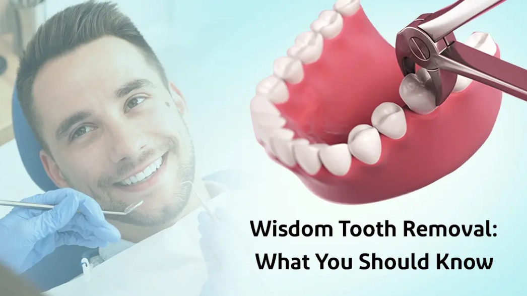 signs you need wisdom teeth out