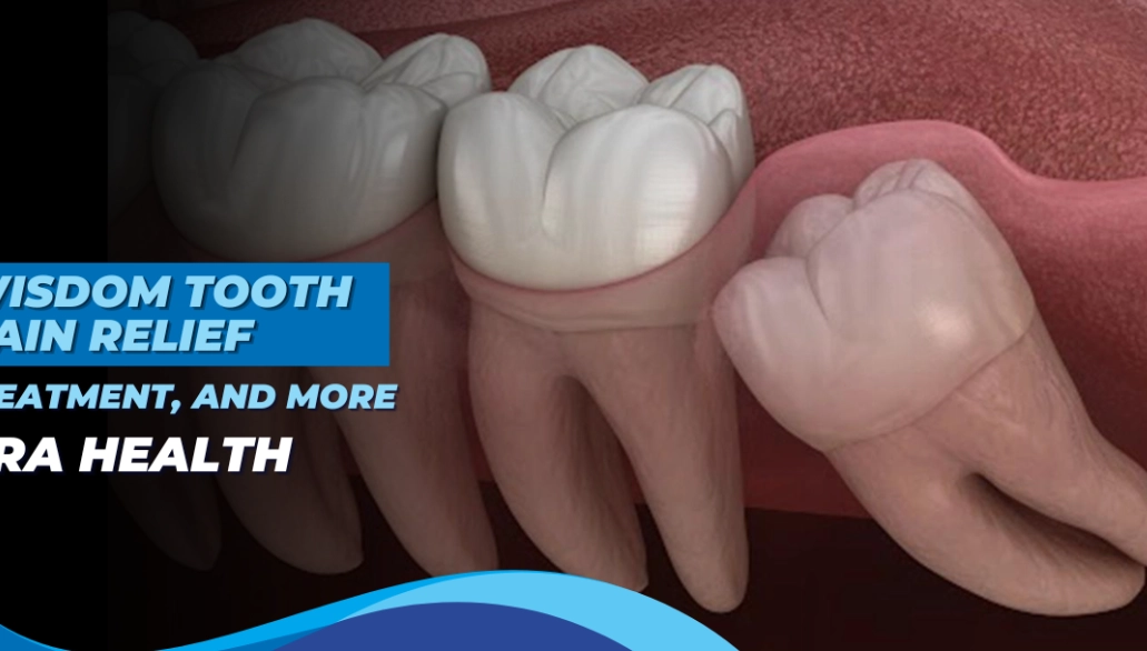 wisdom tooth pain relief