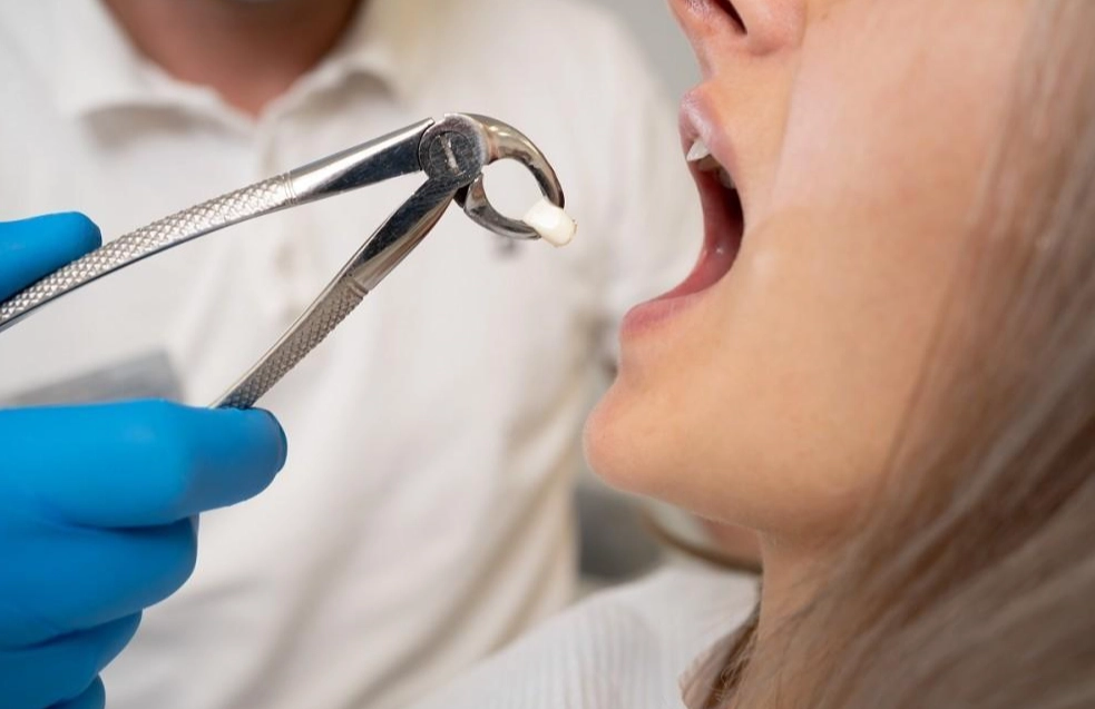 how long does wisdom teeth recovery take