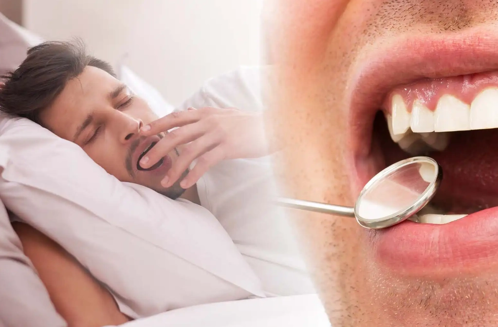 bruxism and sleep disorders