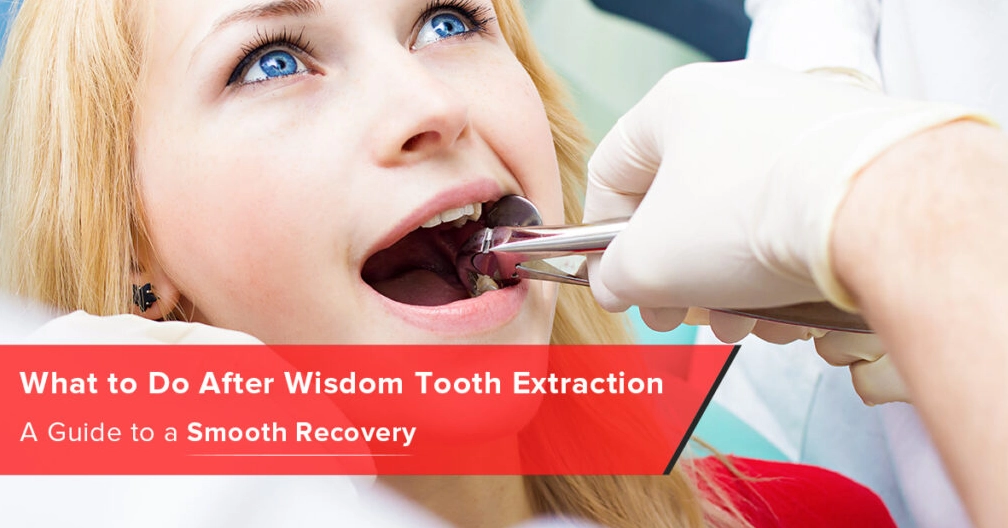 Wisdom Teeth Recovery: 10 Essential Tips for Faster Healing