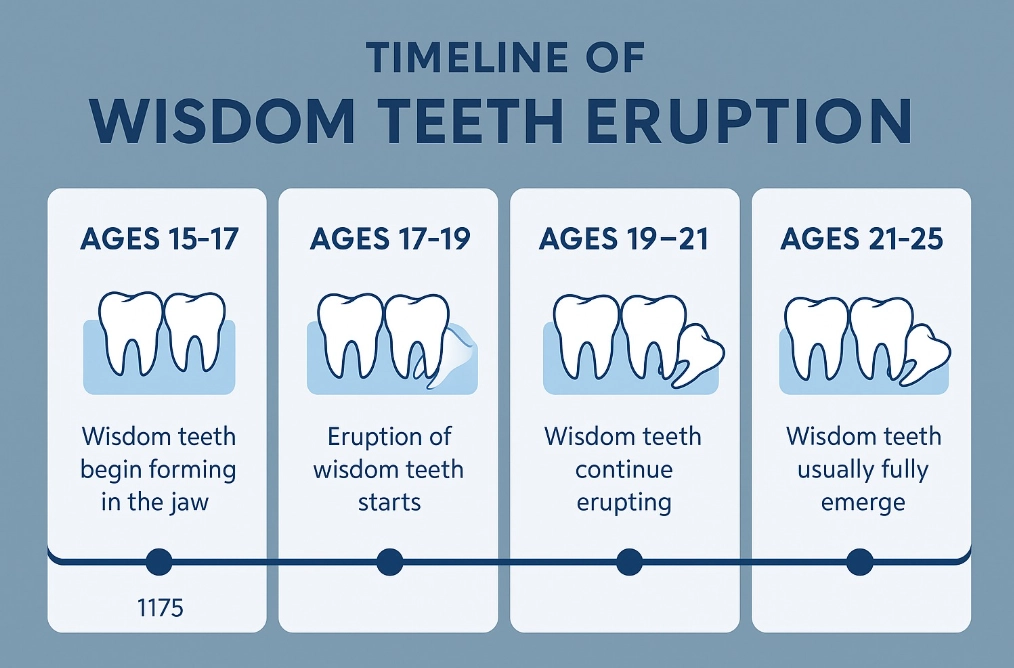 wisdom teeth removal age