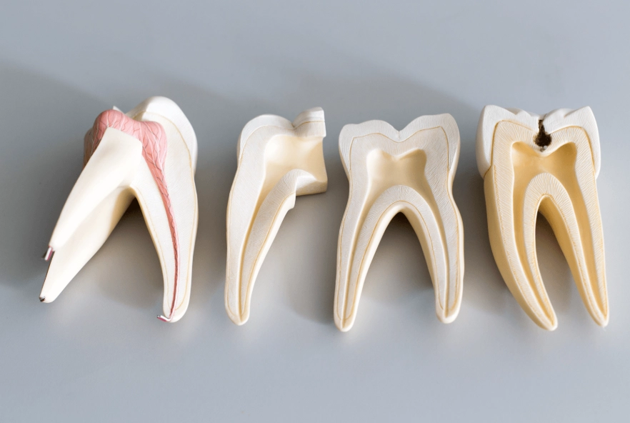 front tooth root canal appearance