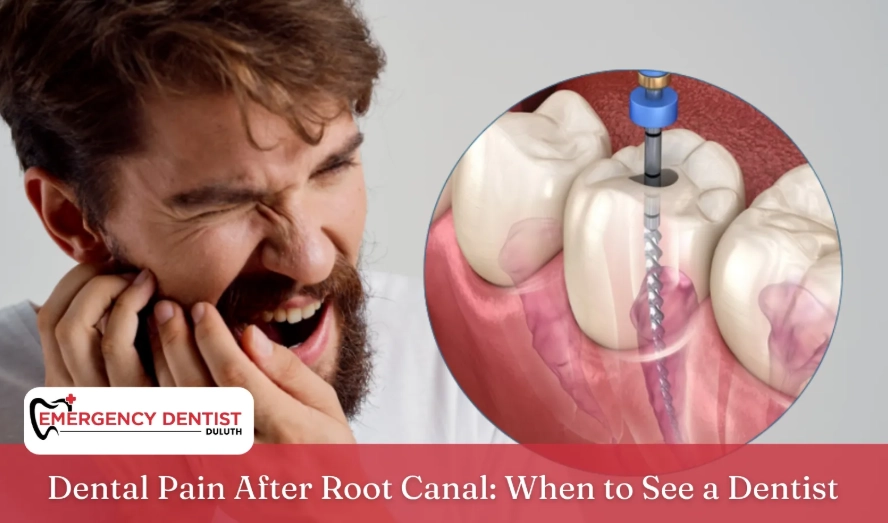 root canal recovery pain