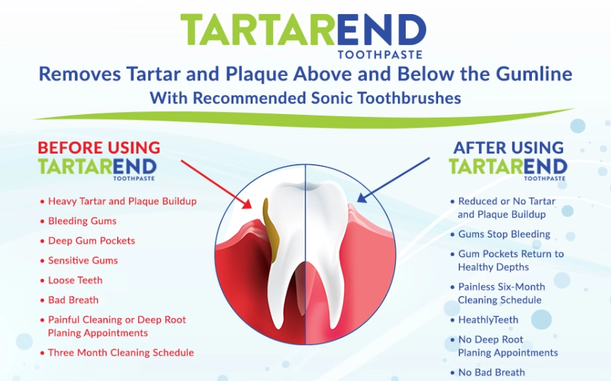 how to remove tartar from teeth