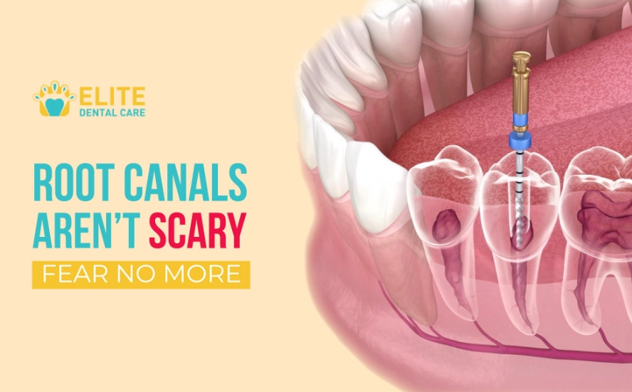 is root canal treatment painful