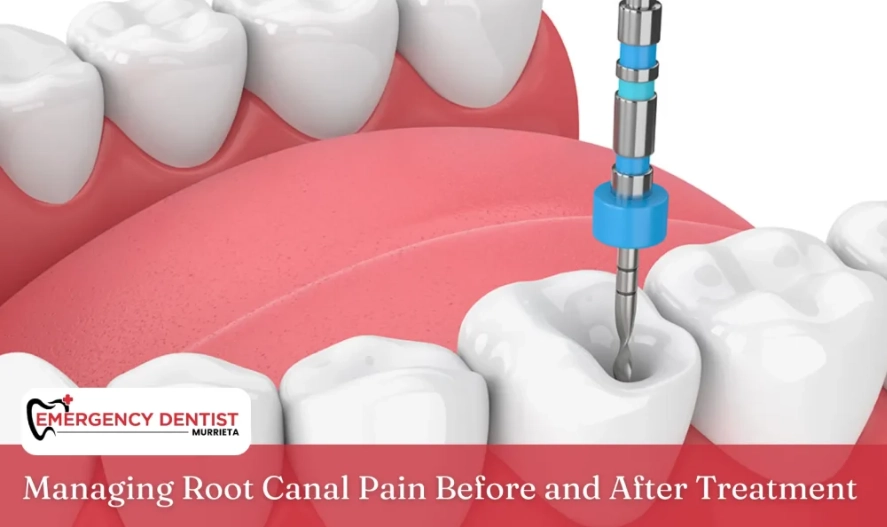 is root canal treatment painful