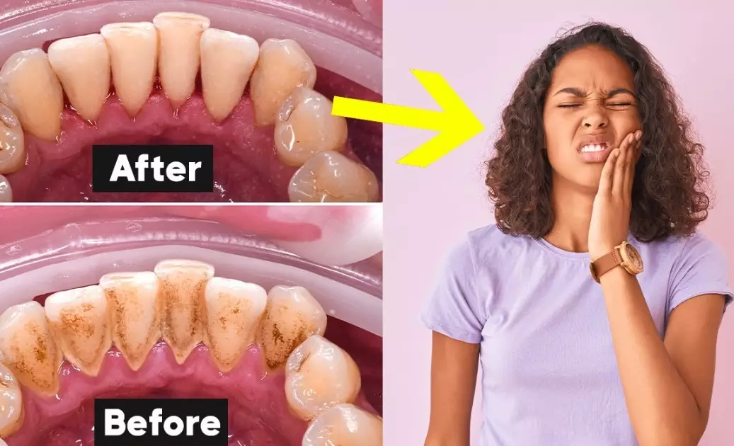 quarterly dental cleaning