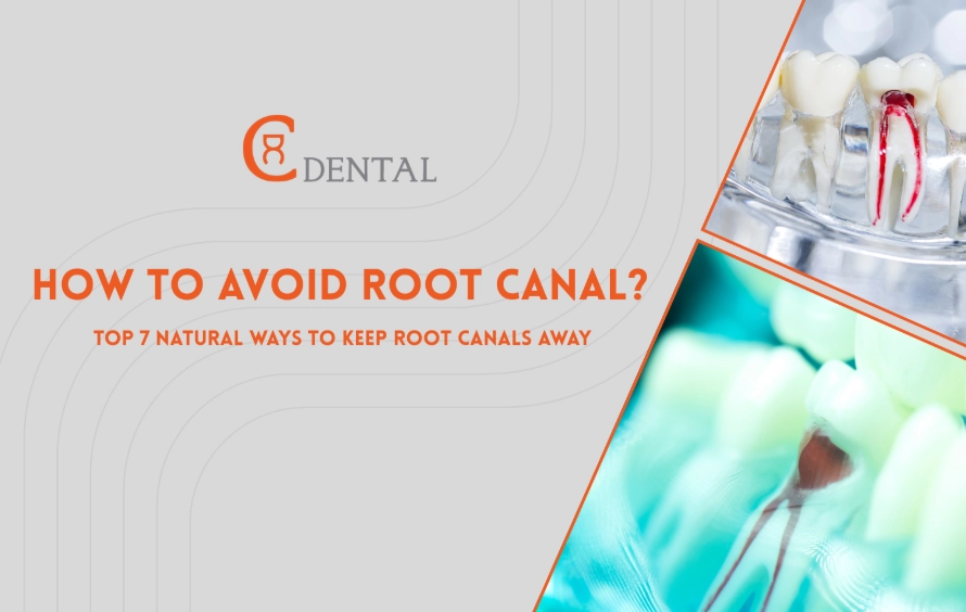 How to avoid root canal