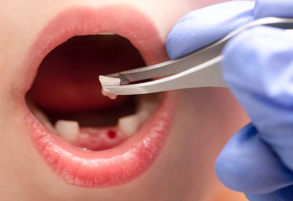 home remedies for toothache home remedies for toothache