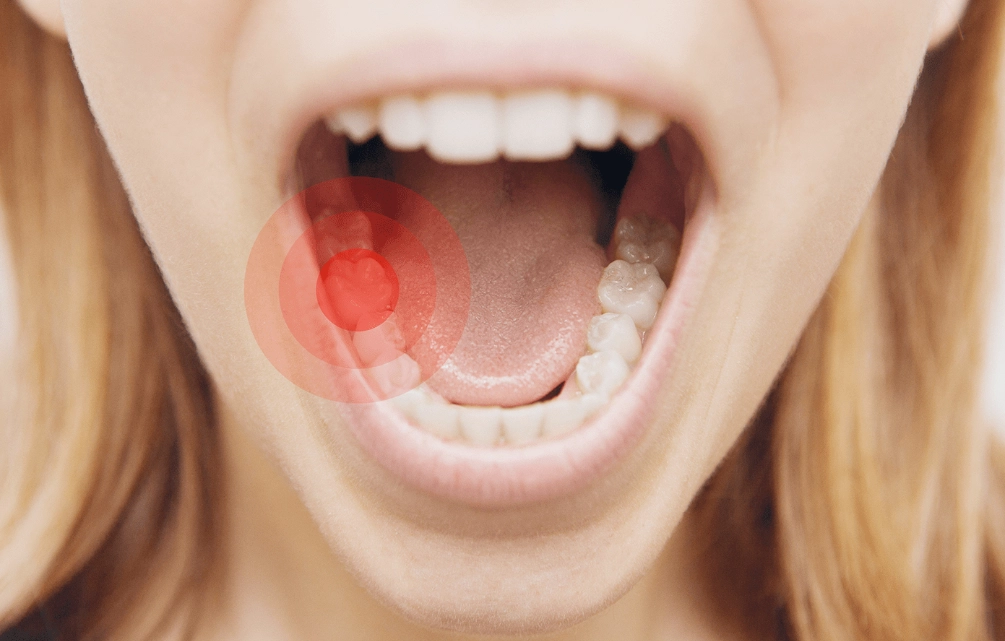 stop tooth pain stop tooth pain