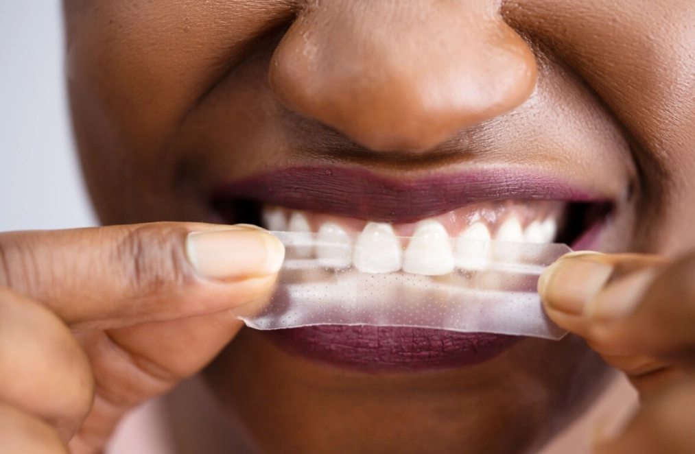 dentist recommended whitening dentist recommended whitening