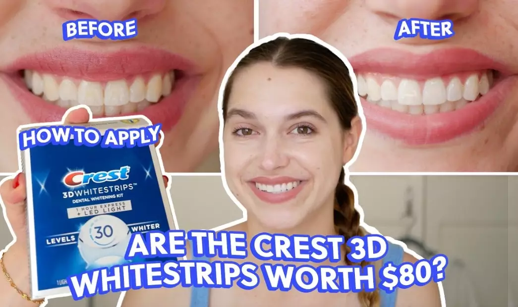 at-home teeth whitening