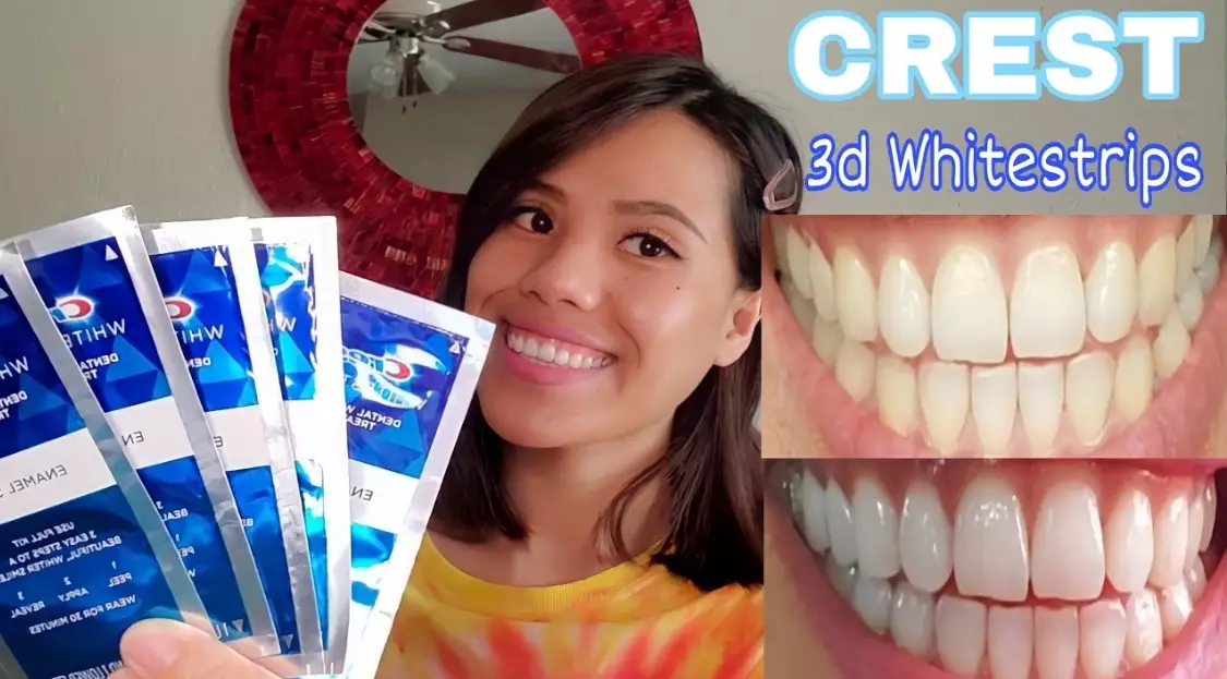 at-home teeth whitening