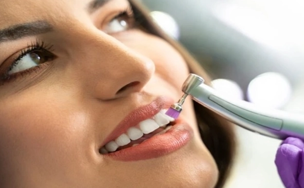 white teeth at home