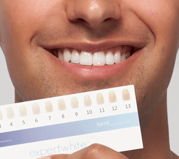 whiter teeth