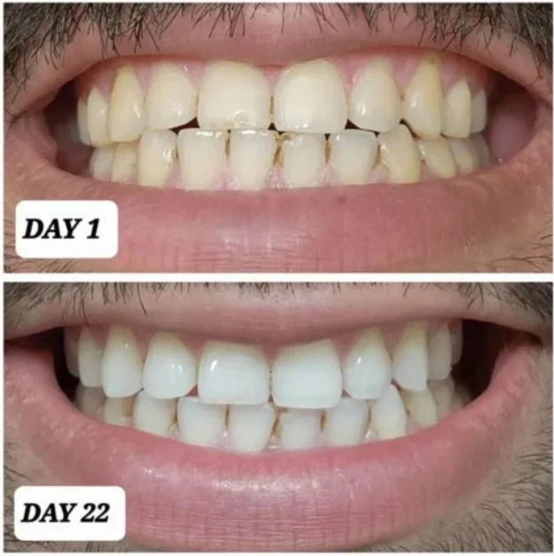 how long do crest whitening strips take to work