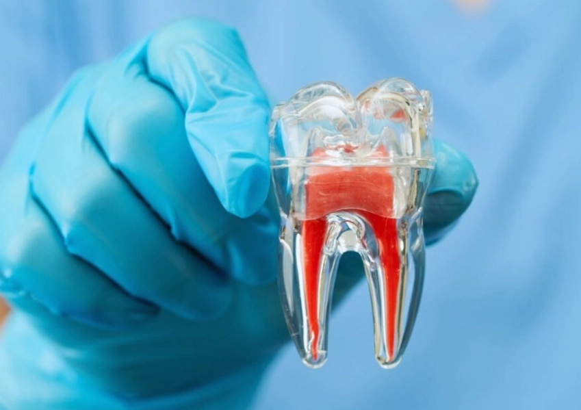 root canal causes