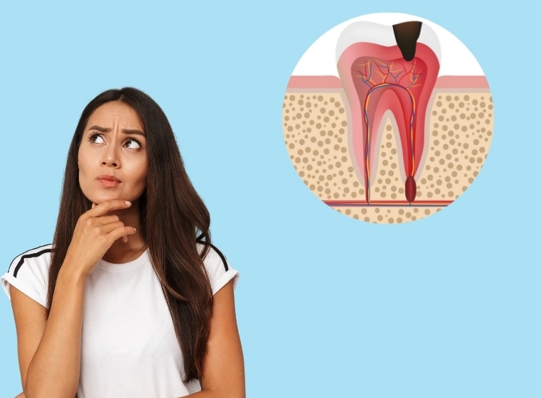 deep tooth decay