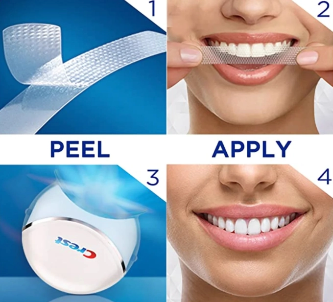 at-home teeth whitening