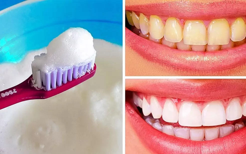 home remedies for white teeth