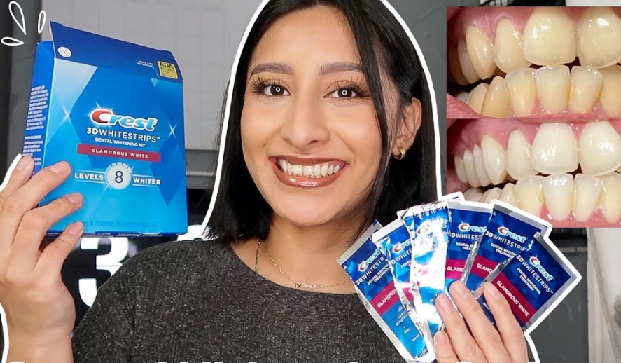 at-home teeth whitening