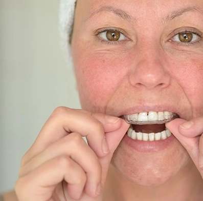 sleep bruxism treatment