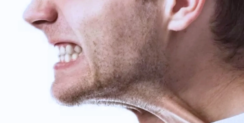 sleep bruxism treatment