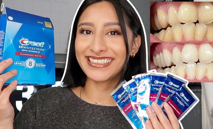 teeth whitening strips immediate results