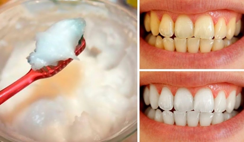 home teeth whitening without baking soda